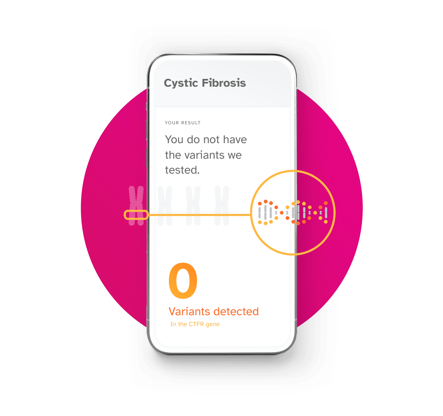 Phone screen showing Cystic Fibrosis report. Example result is You do not have the variants we tested; 0 variants detected in the CFTR gene.