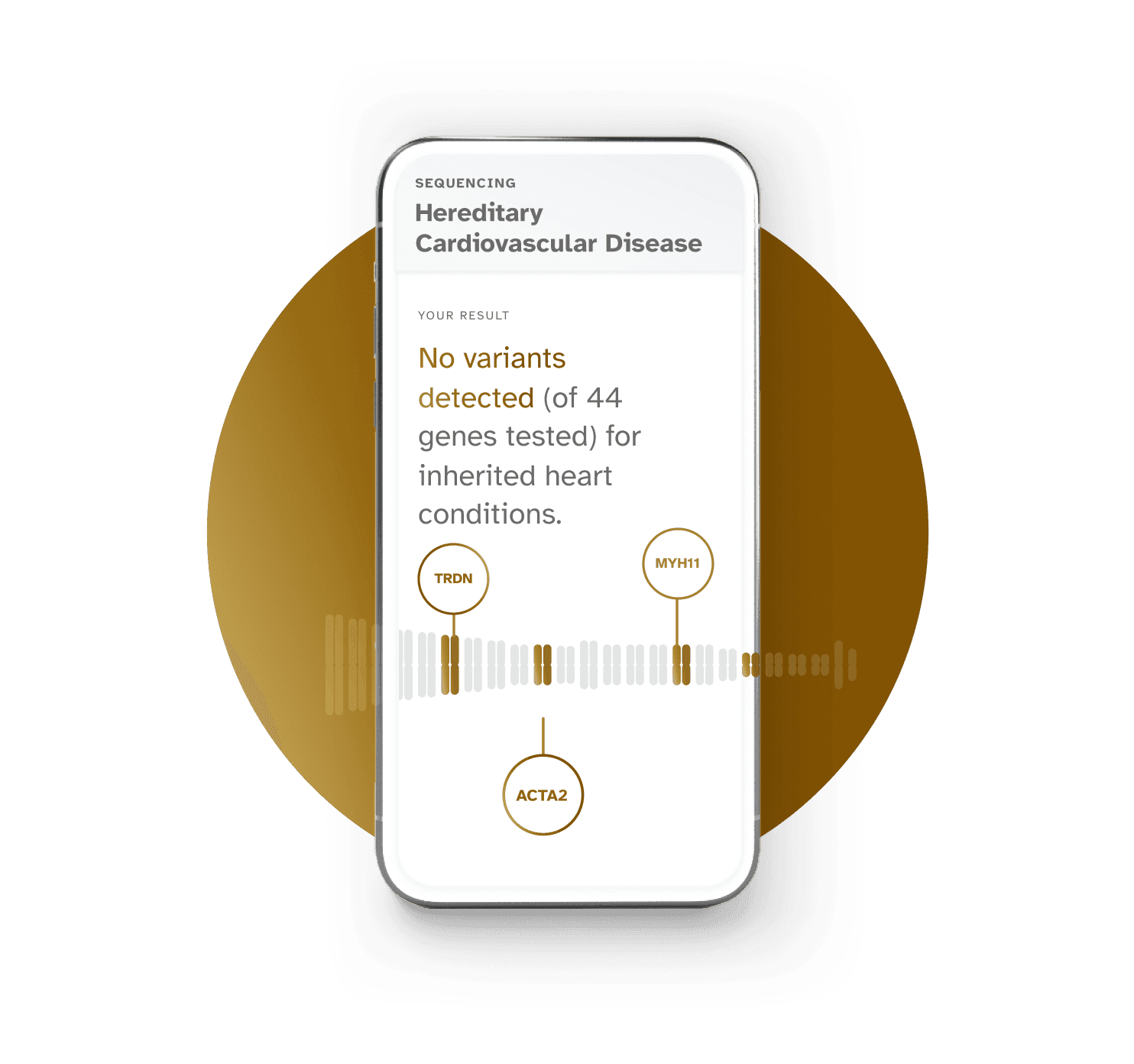 Phone screen showing the Hereditary Cardiovascular Disease report. Example result is No variants detected (of 44 genes tested) for inherited conditions. TRDN, ACTA2, and MYH11 genes shown.